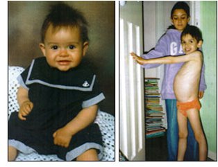 healthy baby - sick boy